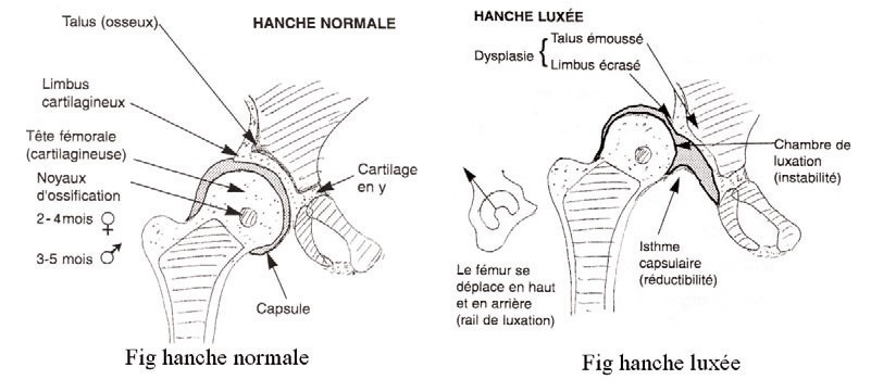 durere în articulația piciorului din stânga unguente pentru tratamentul artrozei articulației cotului